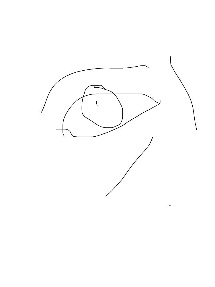 Depressed eyeball by roselily1111